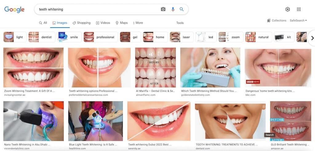 Example of alt-text for teeth whitening